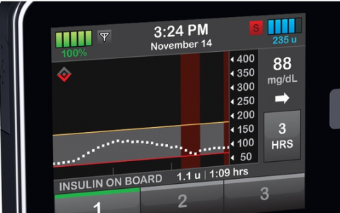 Tandem使第一台可互操作的胰岛素泵获得FDA的好评