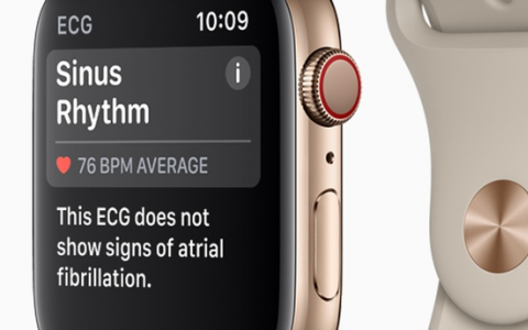新Apple Watch增加了FDA批准的ECG应用程序