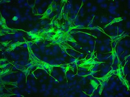 研究为星形胶质细胞如何帮助大脑处理信息提供了新的见解