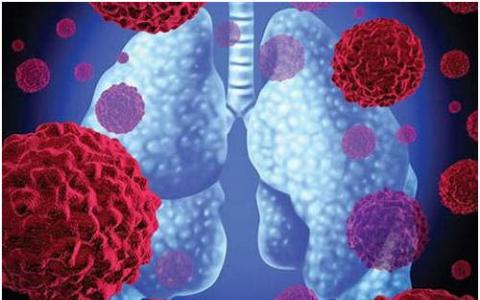 科学家们发现了治疗非小细胞肺癌的潜在新途径