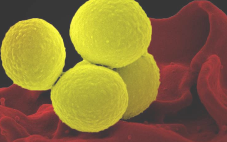 移植好的细菌杀死金黄色葡萄球菌