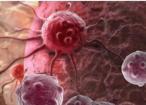 Myriad的BRCA测试支持成功的卵巢癌试验