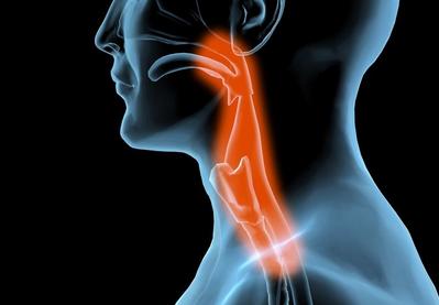慢性咽喉清洁可能是人体对刺激物的反应