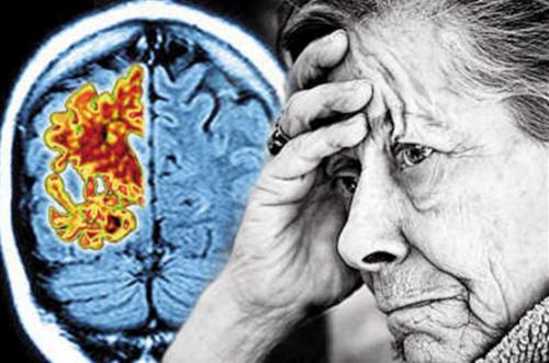 慢性应激与磷酸化头型 阿尔茨海默氏症的治疗建议