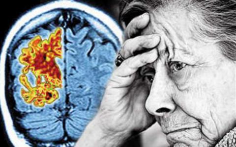 慢性应激与磷酸化头型 阿尔茨海默氏症的治疗建议