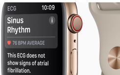 新的Apple Watch添加了FDA批准的ECG应用
