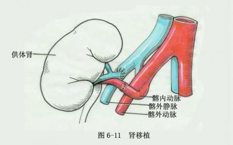 尽管政策改变 早期肾脏移植仍存在差异