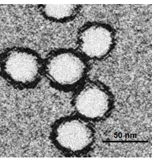 德国报告西尼罗河病毒的标志性病例