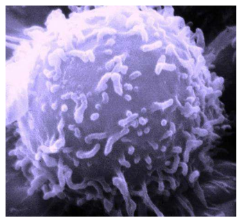 病人的癌细胞在新的3-D支架上可靠地生长 显示出用于精准医学的希望
