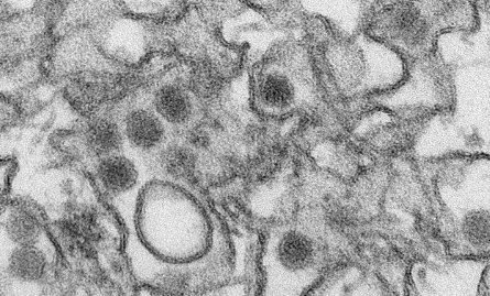 基于DNA的Zika疫苗可防止感染 脑部损伤和死亡