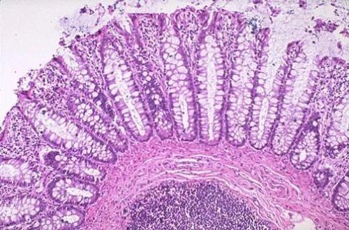 科学家发现肠道细胞会影响生物钟