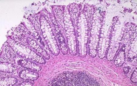 科学家发现肠道细胞会影响生物钟