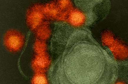 研究人员探索寨卡病毒感染如何引起小头畸形