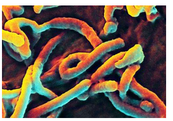 研究人员确定蛋白质在埃博拉病毒复制所需的途径中的作用