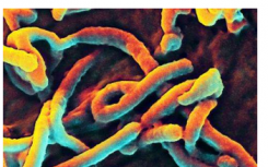 研究人员确定蛋白质在埃博拉病毒复制所需的途径中的作用