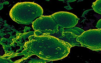 第二位美国患者被鉴定出具有超抗性细菌