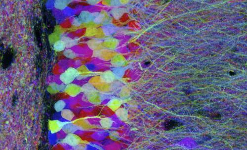 在雄性和雌性小鼠中发现罕见的性别特异性脑细胞