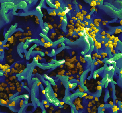 实验疫苗可保护猕猴免受HIV感染