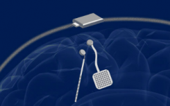 研究人员开发了无线 大脑起搏器