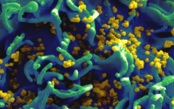 实验疫苗可保护猕猴免受HIV感染