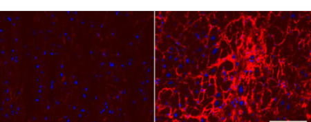 科学家在人类心脏肌肉中发现分子网