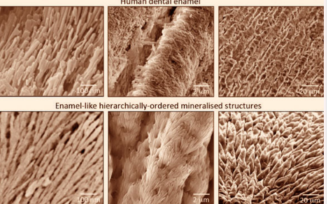 研究人员开发出可以使牙釉质再生的新型矿化材料