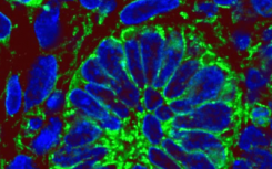 研究人员使用干细胞创建功能正常的人肾脏组织