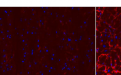 科学家在人类心脏肌肉中发现分子网