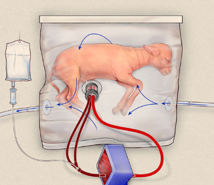 新的类似子宫的设备可能会改变极早婴儿的护理