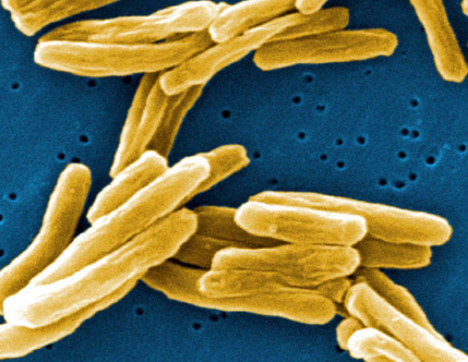 科学家创造了新的抗结核疫苗