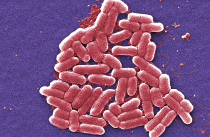 在美国细菌中具有共利斯汀抗性基因的第二例