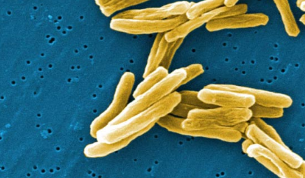 研究人员发现抑制结核分枝杆菌的新方法