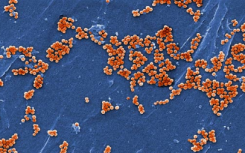 研究人员发现攻击金黄色葡萄球菌的新方法