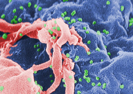 科学家称 孩子因感染艾滋病毒而感染艾滋病
