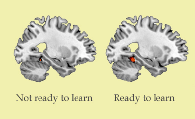 脑部扫描可以预测您的学习技能