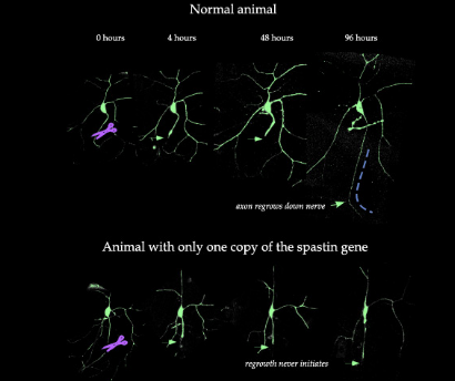 科学家确定了神经再生所需的基因