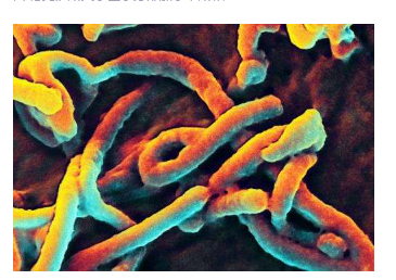 研究人员了解埃博拉病毒如何破坏人体的免疫防御能力