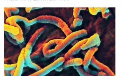 研究人员了解埃博拉病毒如何破坏人体的免疫防御能力
