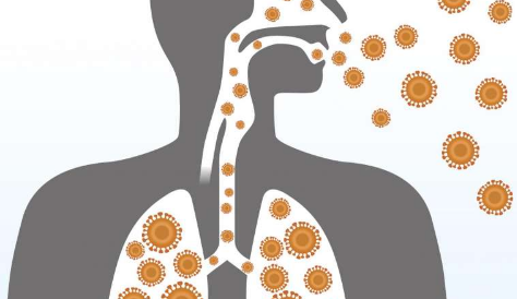 中东呼吸综合症与更高的死亡率 更严重的疾病相关