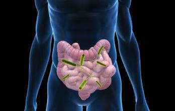 肠道钙的吸收可能会给有发展成肾结石危险的个体带来ID