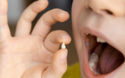 婴儿牙齿中的金属可以帮助揭示导致自闭症的原因
