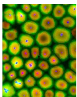 蛙卵破裂的细胞质组织成细胞状结构 保留了分裂的能力