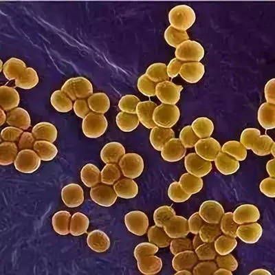金黄色葡萄球菌可从血液传播到眼睛 危害视力