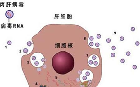 丙肝替代性肝硬化中无需避免他汀类药物