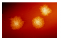艰难梭菌的冷冻与新鲜粪便移植 感染显示出相似的效果