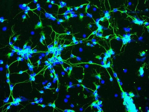 一个由国际人脑项目研究人员组成的国际研究小组放大了纹状体中的神经元回路