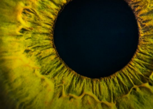 阿尔茨海默氏病在视网膜变薄和增厚的早期出现