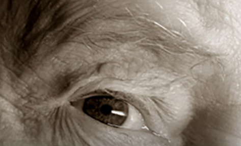 眼瞳孔扩张可能作为阿尔茨海默氏症的筛查测试
