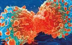 科学家使用催化剂从体内破坏癌细胞