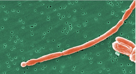 新研究揭示肠道菌群与多发性硬化之间的联系